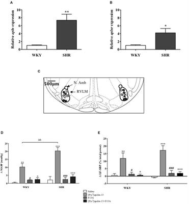 Blockade of Rostral Ventrolateral Medulla Apelin Receptors Does Not Attenuate Arterial Pressure in SHR and L-NAME-Induced Hypertensive Rats